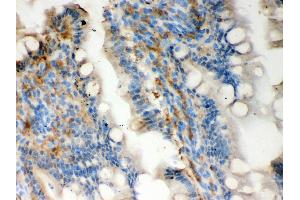 Anti- Galectin3 Picoband antibody, IHC(P) IHC(P): Rat Intestine Tissue (Galectin 3 anticorps  (AA 153-264))