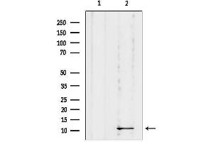 Western blot analysis of lysates from Mouse Myeloma cells, using DYNLR Antibody.