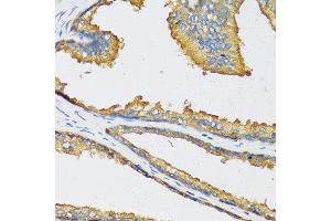 Immunohistochemistry of paraffin-embedded human prostate using CXCL11 antibody at dilution of 1:100 (40x lens). (CXCL11 anticorps)