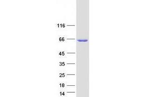 Validation with Western Blot