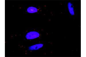 Proximity Ligation Analysis of protein-protein interactions between GRAP2 and CSF1R.