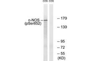 Western blot analysis of extracts from A549 cells, using n-NOS (Phospho-Ser852) Antibody. (NOS1 anticorps  (pSer852))