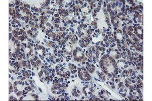 Image no. 2 for anti-Prefoldin Subunit 3 (PFDN3) antibody (ABIN1501707)