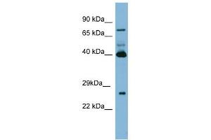 Transglutaminase 3 antibody used at 1 ug/ml to detect target protein.