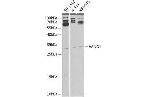 Western blot analysis of extracts of various cell lines, using H antibody (ABIN6128001, ABIN6141595, ABIN6141596 and ABIN6225185) at 1:1000 dilution. (HAND1 anticorps  (AA 16-215))