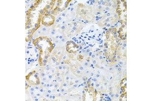 Immunohistochemistry of paraffin-embedded rat kidney using STRN3 antibody (ABIN6129134, ABIN6148646, ABIN6148648 and ABIN6222490) at dilution of 1:100 (40x lens).