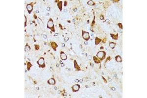 Immunohistochemistry of paraffin-embedded rat brain using COPA Rabbit mAb (ABIN7266423) at dilution of 1:100 (40x lens).
