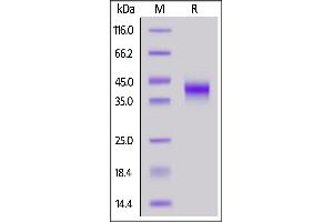 Biotinylated Human FOLR1, His,Avitag on  under reducing (R) condition.
