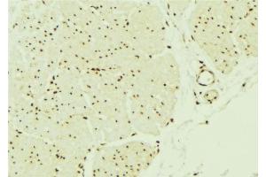 ABIN6276512 at 1/100 staining Mouse muscle tissue by IHC-P. (SMAD1 anticorps  (Internal Region))