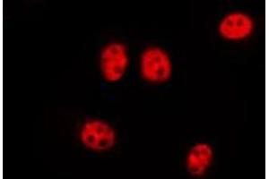 ABIN6277187 staining Hela by IF/ICC.