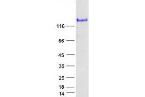 Validation with Western Blot