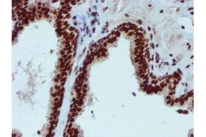 Image no. 13 for anti-Peptidyl Arginine Deiminase, Type IV (PADI4) antibody (ABIN1500017)