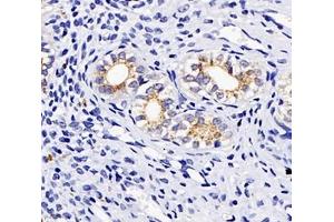 Immunohistochemistry analysis of paraffin-embedded rat uterus using,TSPAN1 (ABIN7075867) at dilution of 1: 4000 (TSPAN1 anticorps)