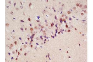 Formalin-fixed and paraffin embedded rat brain labeled with Rabbit Anti-Drebrin Polyclonal Antibody, Unconjugated (ABIN873130) at 1:200 followed by conjugation to the secondary antibody and DAB staining (DBN1 anticorps  (AA 151-250))