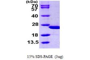 SDS-PAGE (SDS) image for Calcyphosine (CAPS) (AA 1-189) protein (His tag) (ABIN667359)