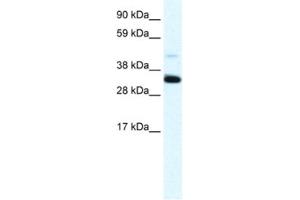 Western Blotting (WB) image for anti-Annexin A3 (ANXA3) antibody (ABIN2461372) (Annexin A3 anticorps)