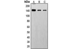 Western blot analysis of FGFR1 (pY766) expression in HepG2 EGF-treated (A), SP2/0 EGF-treated (B), PC12 EGF-treated (C) whole cell lysates. (FGFR1 anticorps  (C-Term, pTyr766))