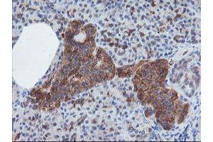 Image no. 2 for anti-Crystallin, Zeta, Homolog antibody (ABIN1497654)