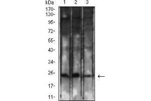 Western blot analysis using CD8a mouse mAb against K562 (1), Jurkat (2), and HL-60 (3) cell lysate.