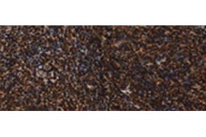 Immunohistochemistry of paraffin-embedded Human tonsil tissue using LMNB1 Polyclonal Antibody at dilution of 1:60(x200) (Lamin B1 anticorps)