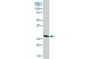 CACYBP MaxPab polyclonal antibody.