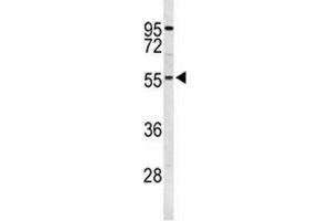 Western blot analysis of S6K2 antibody and K562 lysate. (RPS6KB2 anticorps)
