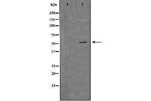 Western blot analysis of extracts from LOVO cells, using MRPS30 antibody.