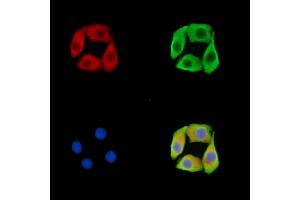 ABIN7095825 and ABIN7099887 staining Hela cells by IF/ICC.