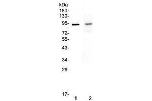Western blot testing of 1) rat spleen and 2) mouse intestine lysate with TLR1 antibody at 0. (TLR1 anticorps)