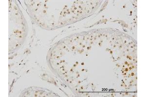Image no. 1 for anti-Interleukin-1 Receptor-Associated Kinase 4 (IRAK4) (AA 1-130) antibody (ABIN599243) (IRAK4 anticorps  (AA 1-130))