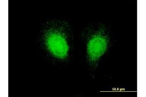 Immunofluorescence of purified MaxPab antibody to CSF2 on HeLa cell.