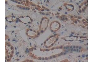 Detection of PKCi in Human Kidney Tissue using Polyclonal Antibody to Protein Kinase C Iota (PKCi)