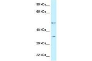 Image no. 1 for anti-6-phosphofructo-2-Kinase/fructose-2,6-Biphosphatase 1 (PFKFB1) (AA 335-384) antibody (ABIN6747350) (PFKFB1 anticorps  (AA 335-384))
