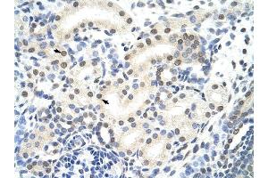 SNRP70 antibody was used for immunohistochemistry at a concentration of 4-8 ug/ml to stain Epithelial cells of renal tubule (arrows) in Human Kidney. (SNRNP70 anticorps)