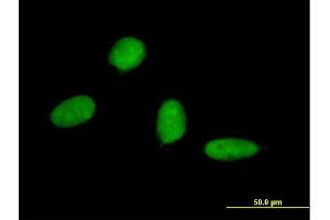 Immunofluorescence of monoclonal antibody to SP7 on HeLa cell. (SP7 anticorps  (AA 87-162))