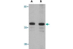 Western blot analysis of CDCA8 in rat kidney tissue lysate with CDCA8 polyclonal antibody  at (A) 1 and (B) 2 ug/mL . (CDCA8 anticorps  (N-Term))
