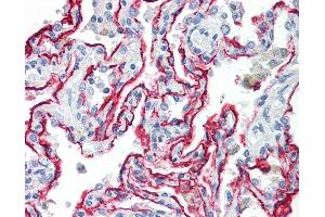 Anti-AGER / RAGE antibody IHC of human lung.