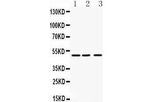 Anti- ANGPTL4 antibody, Western blotting All lanes: Anti ANGPTL4  at 0. (ANGPTL4 anticorps  (C-Term))