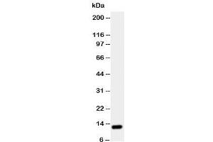 Western blot testing of TFF1 antibody and rat stomach tissue lysate (TFF1 anticorps  (Middle Region))