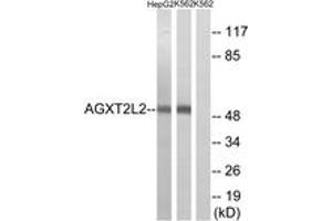 Western blot analysis of extracts from K562/HepG2 cells, using AGXT2L2 Antibody. (AGXT2L2 anticorps  (AA 341-390))