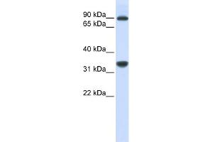WB Suggested Anti-RRP1B Antibody Titration:  0. (RRP1B anticorps  (Middle Region))