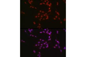 Immunofluorescence analysis of U2OS cells using CREB1 Rabbit pAb (ABIN7266053) at dilution of 1:50 (40x lens).