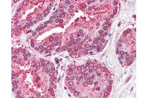 Anti-TSPAN6 antibody IHC of human prostate.