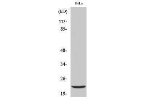 Western Blotting (WB) image for anti-Parkinson Protein 7 (PARK7) (Internal Region) antibody (ABIN3184312) (PARK7/DJ1 anticorps  (Internal Region))