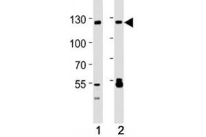 Western blot analysis of lysate from A549, 293 cell line (left to right) using SIRT-1 antibody