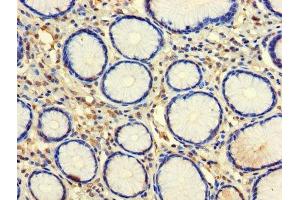 Immunohistochemistry of paraffin-embedded human stomach tissue using ABIN7146057 at dilution of 1:100