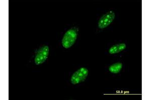 Immunofluorescence of monoclonal antibody to IQGAP3 on HeLa cell. (IQGAP3 anticorps  (AA 602-698))