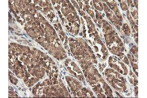 Image no. 5 for anti-Phosphoinositide-3-Kinase, Catalytic, gamma Polypeptide (PIK3CG) antibody (ABIN1500207)