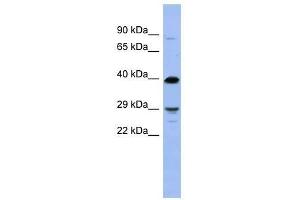 OLIG3 antibody used at 5 ug/ml to detect target protein. (OLIG3 anticorps  (N-Term))
