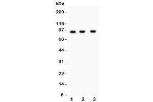 Western blot testing of NEDD9 antibody and Lane 1:  Jurkat (NEDD9 anticorps)